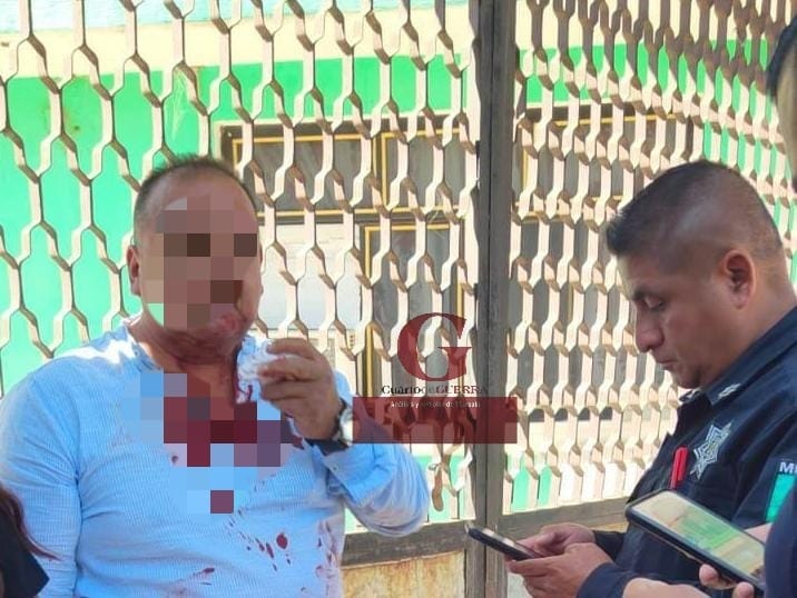 Asalto violento y a plena luz del día en Zacatelco; hombre resulta herido